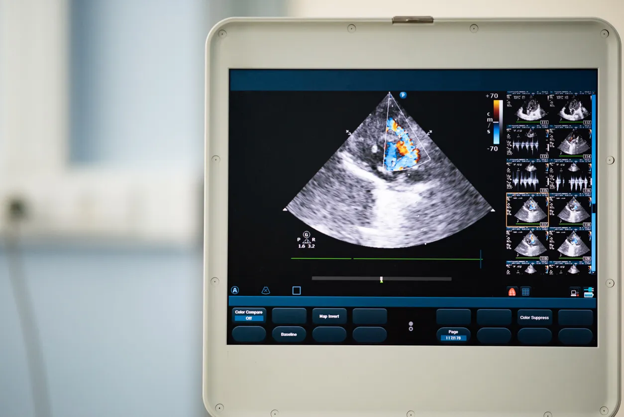 koeputkihedelmöityksen hinta, paljonko ivf maksaa