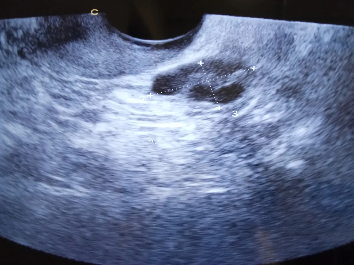 aamulämmön mittaaminen