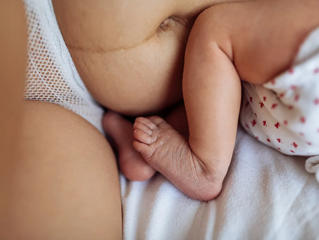 synnytyksestä palautuminen